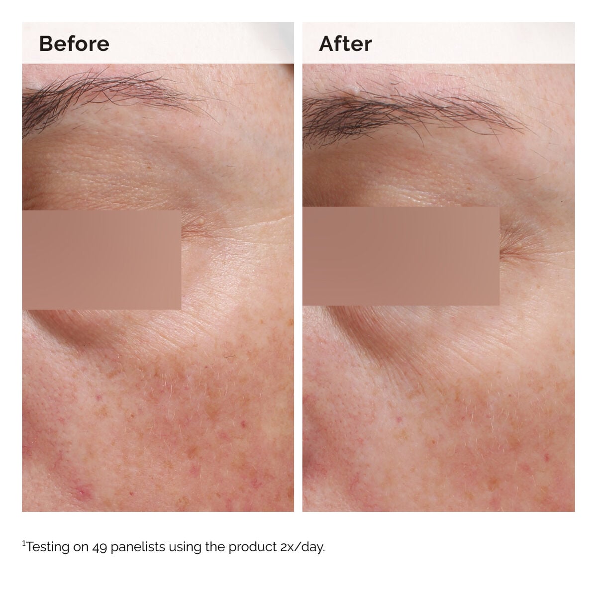 niacinamide-5-face-and-body-emulsion-b0 2024-08-23-ORD-Nia-5pct-Face-Body-B-A-Elasticity-Global-02-1x1.jpg