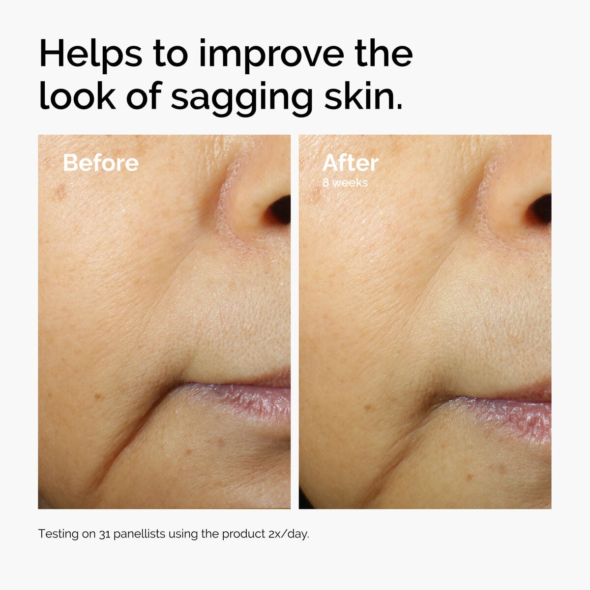 caffeine-3-escin-1-face-serum-d9 ord-caffeine-3pct-escin-1pct-face-serum-before-after-sagging.jpg