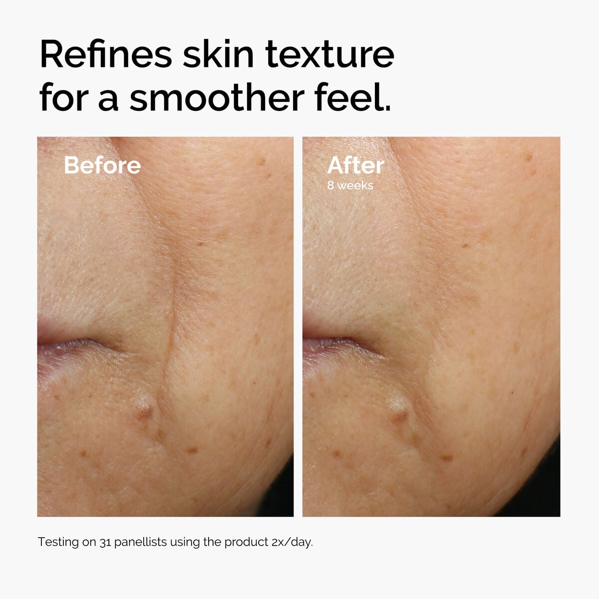 caffeine-3-escin-1-face-serum-d9 ord-caffeine-3pct-escin-1pct-face-serum-before-after-texture.jpg