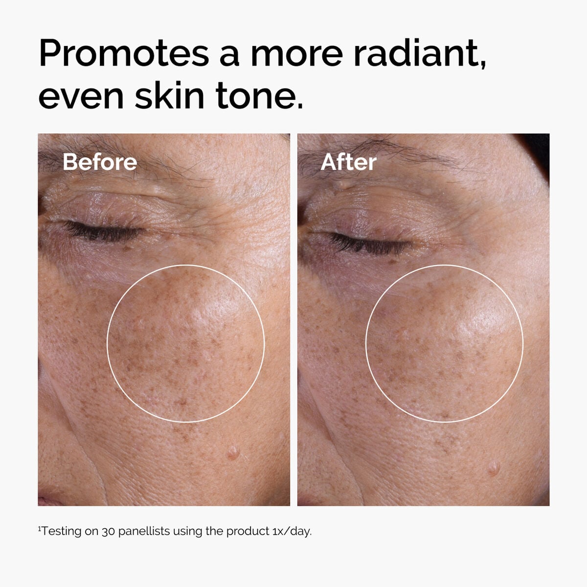 glycolic-acid-7-exfoliating-toner-n5 ord-glycolic-before-after-radiance.jpg
