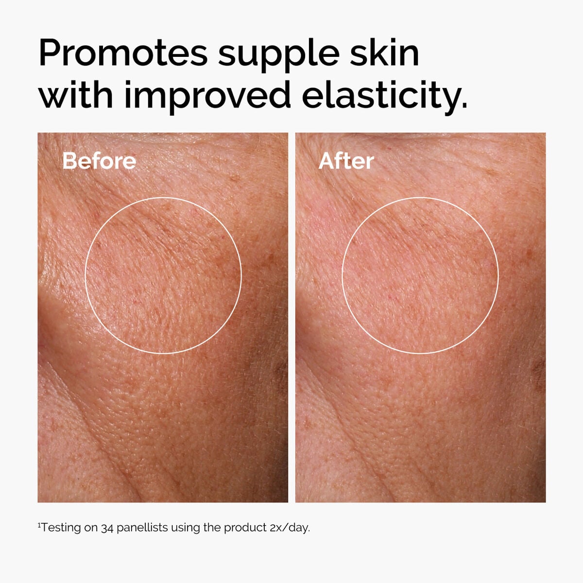 hyaluronic-acid-2-b5-with-ceramides-f2 ord-hyaluronic-acid-2pct-b5-hydrating-serum-before-after-elasticity.jpg