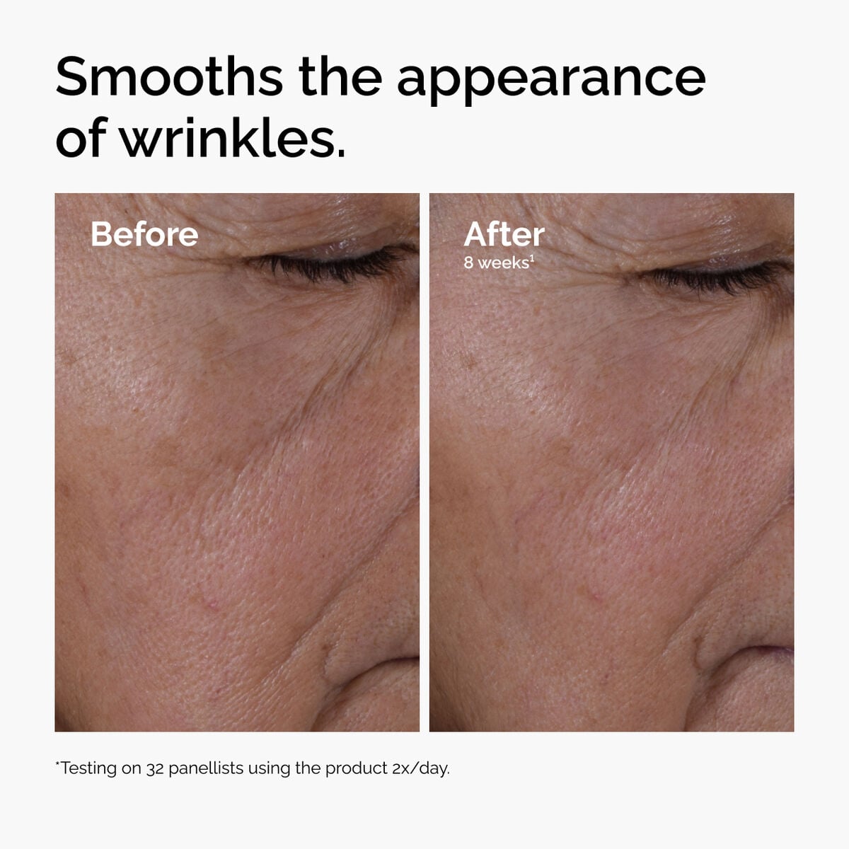 multi-peptide-ha-serum-w8 ord-multi-peptide-ha-serum-wrinkles-before-after.jpg