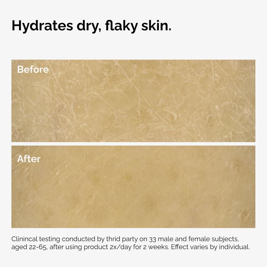 the-body-care-collection-j6 ord-natural-moisturizing-factors-inulin-body-before-after-graphic-02.jpg