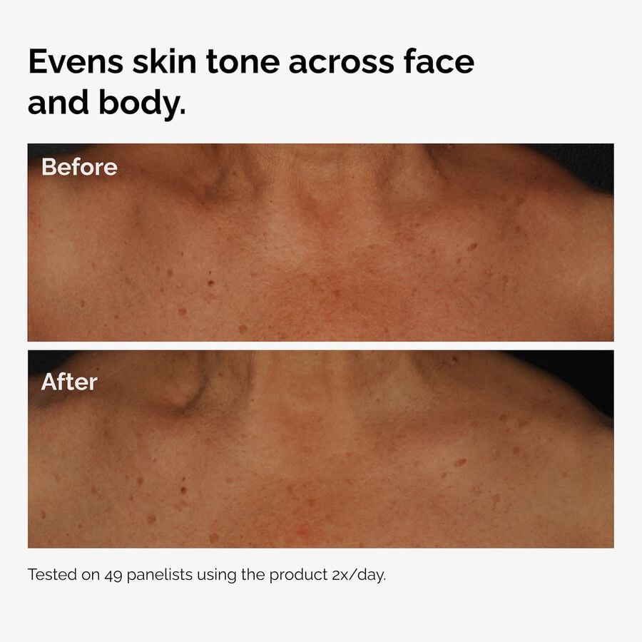 the-body-care-collection-j6 ord-niacinamide-face-body-serum-before-after-even-tone-graphic.jpg