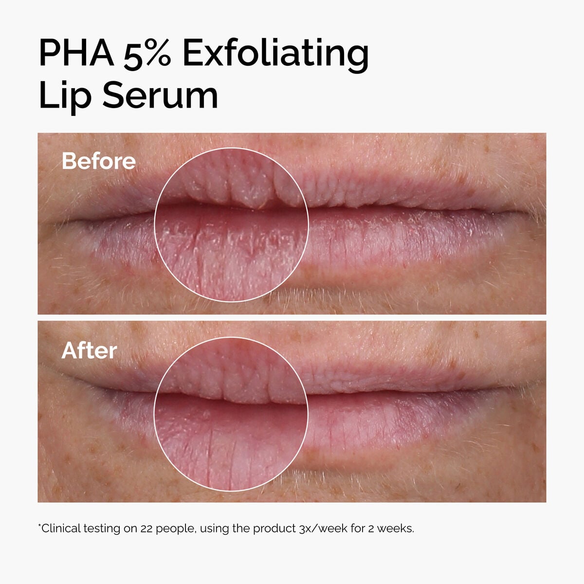 pha-5-exfoliating-lip-serum-f5 ord-pha-5pct-lip-exfoliating-serum-before-after.jpg