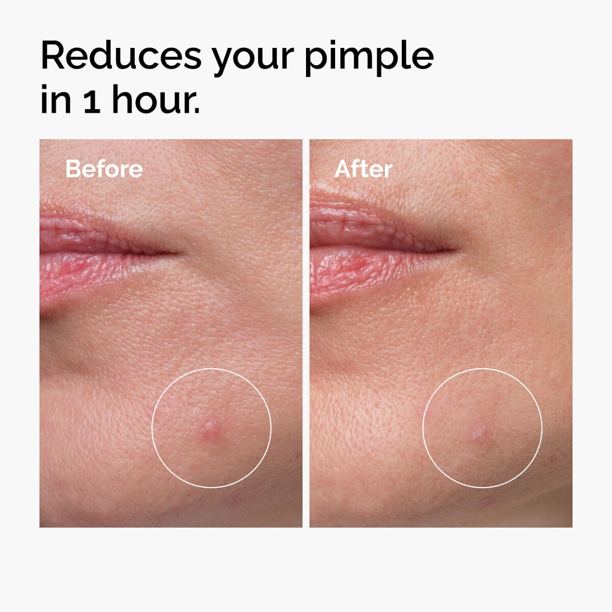 sulfur-10-powder-to-cream-concentrate-u0 ord-sulfur-10pct-powder-to-cream-concentrate-before-after-NA.jpg